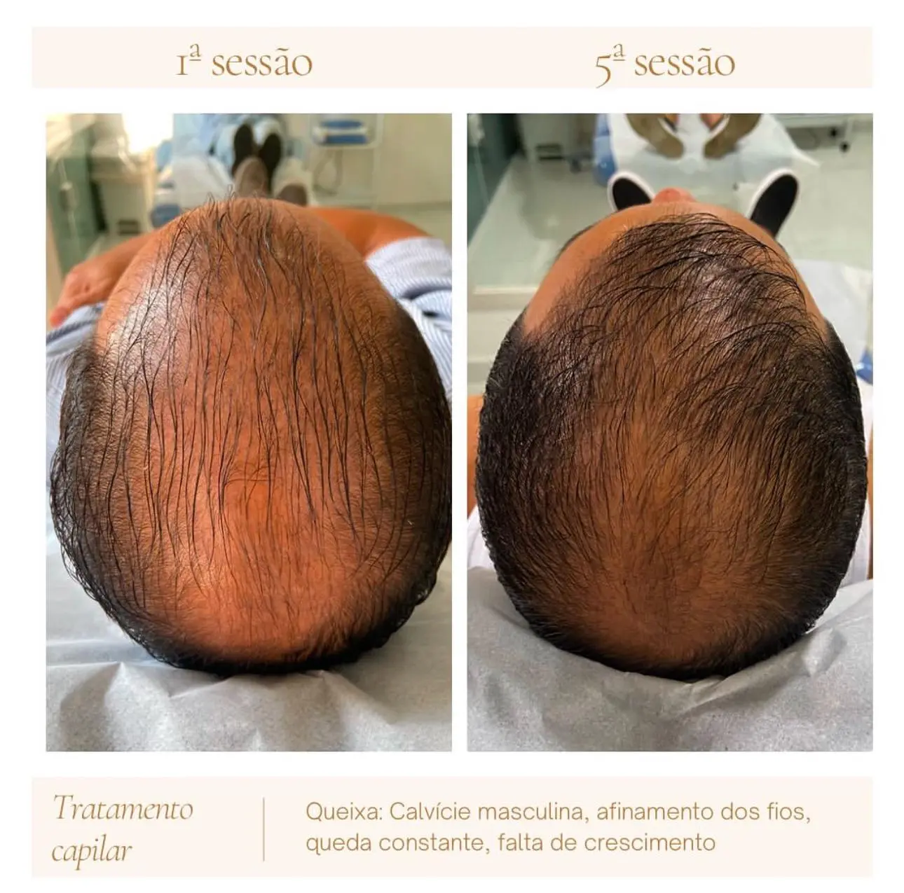 tratamento capilar masculino